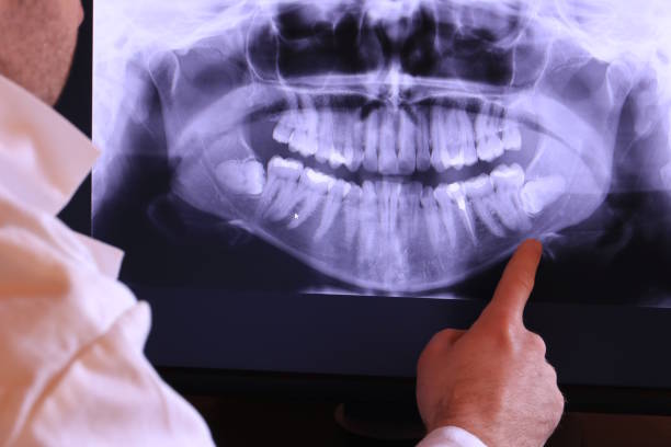 Best Broken or Chipped Tooth Repair in Newport East, RI