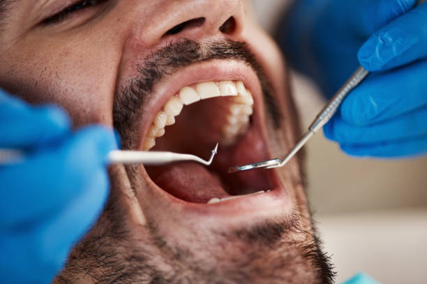 Best Emergency Cosmetic Dentistry (e.g., broken veneers) in Newport East, RI